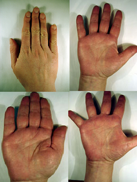 Фото: пример четырех рук